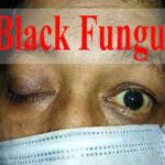Black fungal disease