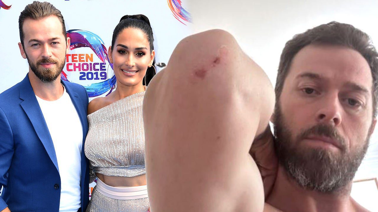 Artem Chigvintsev Accuses Nikki Garcia of Being ‘Primary Aggressor’ in Incident That Led to Arrest