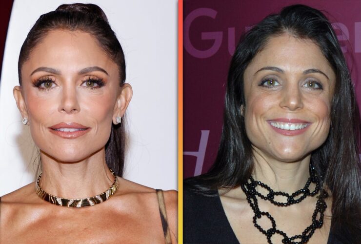 Bethenny Frankel Says ‘Haters’ Are ‘Mad’ She Looks Better Now Than 20 Years Ago Thanks to Botox