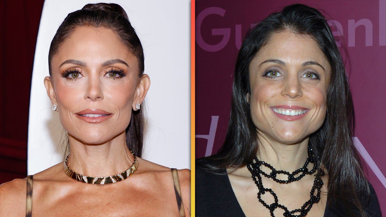 Bethenny Frankel Says ‘Haters’ Are ‘Mad’ She Looks Better Now Than 20 Years Ago Thanks to Botox