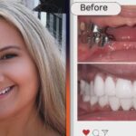 Gypsy Rose Blanchard Shows Off Drastic Teeth Makeover