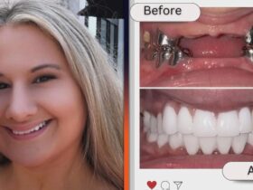 Gypsy Rose Blanchard Shows Off Drastic Teeth Makeover