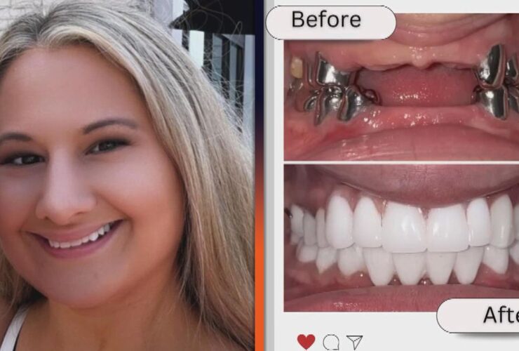 Gypsy Rose Blanchard Shows Off Drastic Teeth Makeover