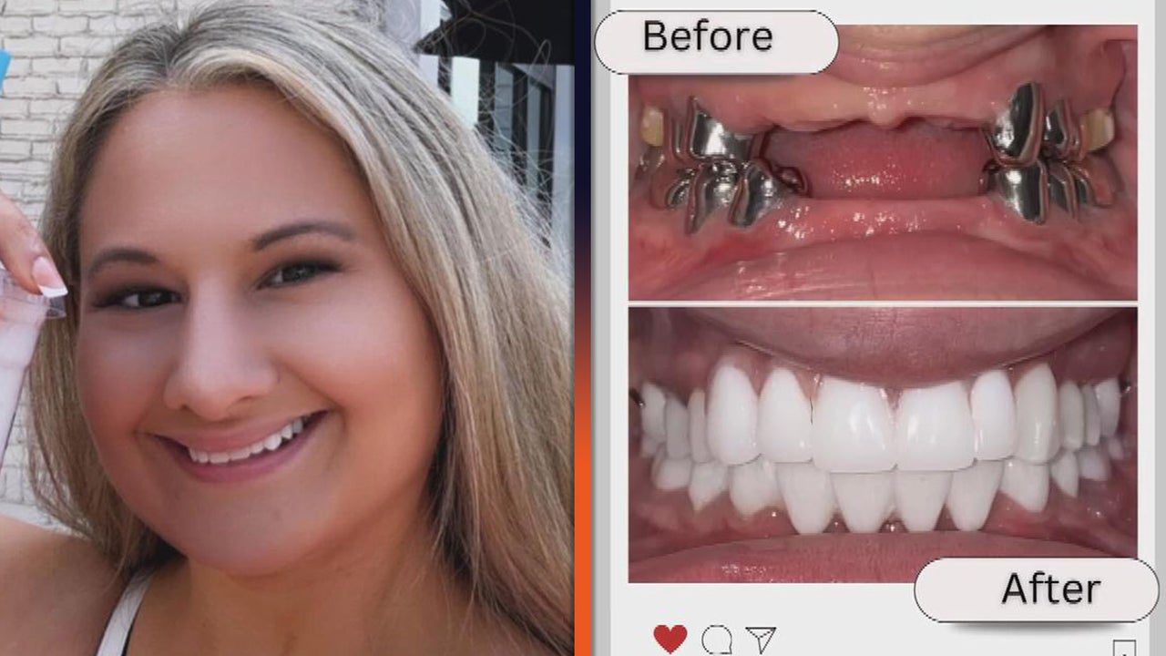 Gypsy Rose Blanchard Shows Off Drastic Teeth Makeover