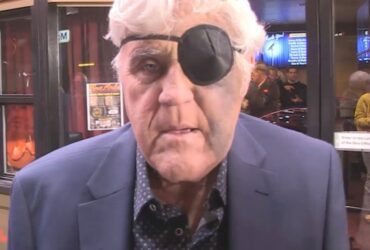 Jay Leno Injures Face in Nasty Fall, 2 Years After Car Fire