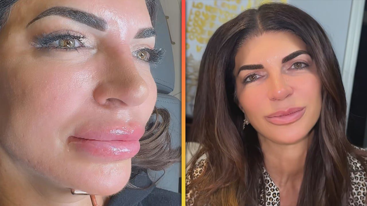 Teresa Giudice Films Herself Removing Lip Filler