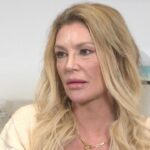 Brandi Glanville Explains Her Face Parasite and Shares Fiery Message to Her Haters (Exclusive)