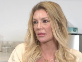 Brandi Glanville Explains Her Face Parasite and Shares Fiery Message to Her Haters (Exclusive)