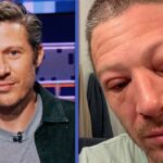 See ‘Criminal Minds: Evolution’ Star Zach Gilford’s Swollen Face After Medical Emergency