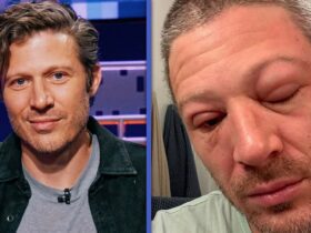 See ‘Criminal Minds: Evolution’ Star Zach Gilford’s Swollen Face After Medical Emergency