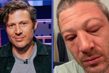 See ‘Criminal Minds: Evolution’ Star Zach Gilford’s Swollen Face After Medical Emergency