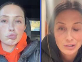 Bristol Palin Reveals She’s Battling Facial Paralysis