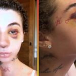 Bhad Bhabie Defends Getting Nose Job Amid Cancer Battle