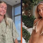 Lindsay Arnold Details Journey to Breast Implant Surgery