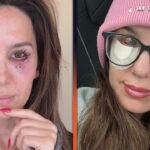 Christy Carlson Romano Reveals Gruesome Injury After She Was Shot in the Face